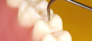 periodontist los angeles