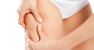 The Need For Cellulite Reduction