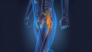 The Recovery Phase from A Hip Replacement Surgery
